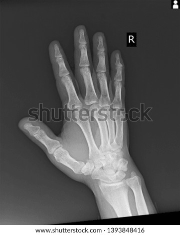X-ray picture of body part