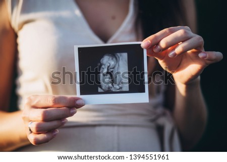 A young beautiful pregnant woman shows a picture of an X-ray of a baby