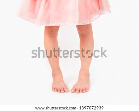 Child 5-6 year old with symptom In-toeing disease,twisted legs,Bow legs. Defect at foots and legs of kid. Metatarsal adductus, Femoral anteversion Royalty-Free Stock Photo #1397072939