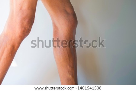 The legs of the elderly who are walking Royalty-Free Stock Photo #1401541508