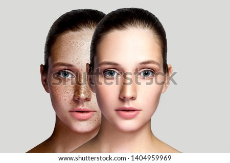 Closeup portrait of beautiful brunette woman with and without freckles on face. healing and removing freckles medical concept. looking at camera. indoor studio shot, isolated on gray background.
