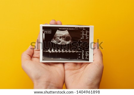 Woman hold ultrasound picture of growing baby in pregnancy time