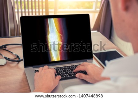 Doctor watching a laptop with x-ray of leg with pain in the bones. Radiology concept