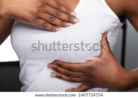 Close-up Of A Woman's Hand On Breast Showing Cancer Symptom Royalty-Free Stock Photo #1407724754