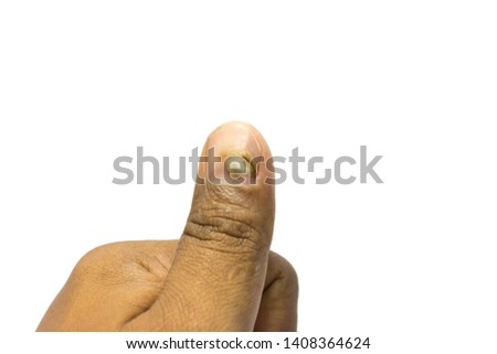 Picture fingers cracked white background