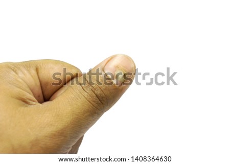 Picture fingers cracked white background