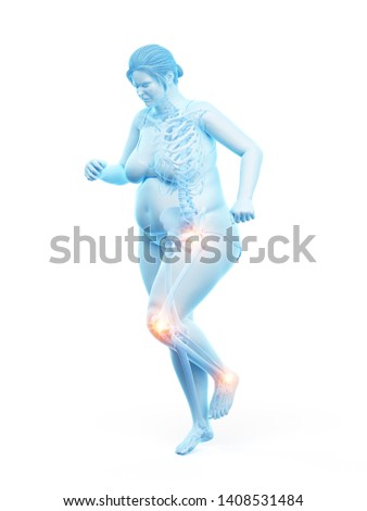3d rendered medically accurate illustration of an obese womans 