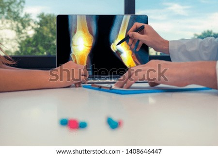 Doctor showing a x-ray of legs with pain in the bones on a laptop to a woman patient.