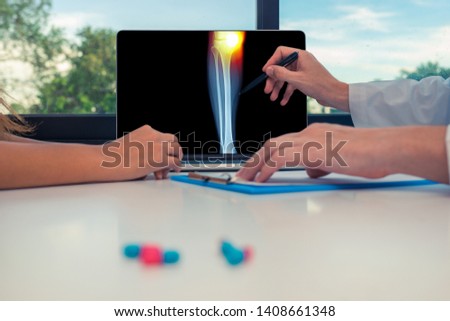 Doctor showing a x-ray of legs with pain in the internal knee on a laptop to a woman patient.