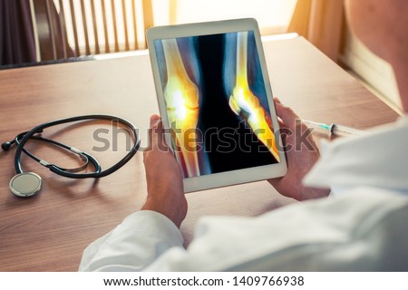 Doctor holding a digital tablet with x-ray of legs with pain. Stethoscope and syringe on the desk