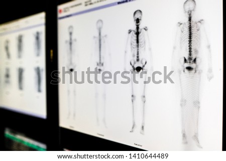 Bone scan of human body, check up concept
