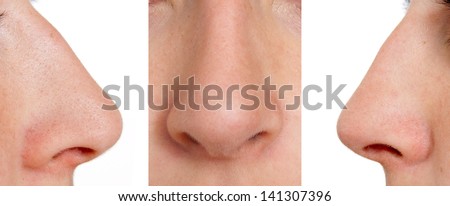 Aquiline nose Royalty-Free Stock Photo #141307396