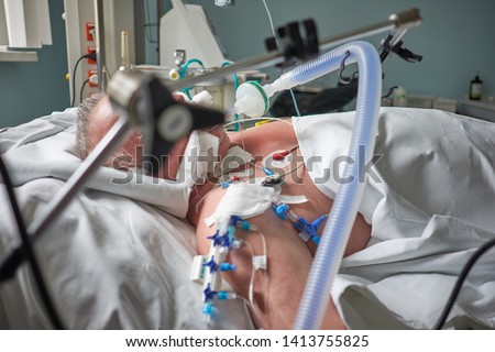 Intubated adult white man under ventilator lying in coma in intensive care department. Patient in critical state. Royalty-Free Stock Photo #1413755825