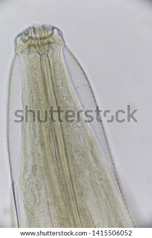 head organs of parasite under microscope view. 