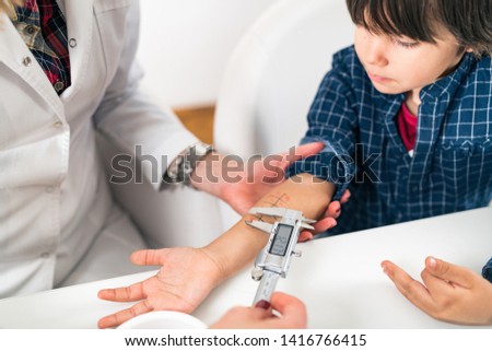 Immunology Doctor Measuring Allergy Reaction of Patient, Little Boy Royalty-Free Stock Photo #1416766415