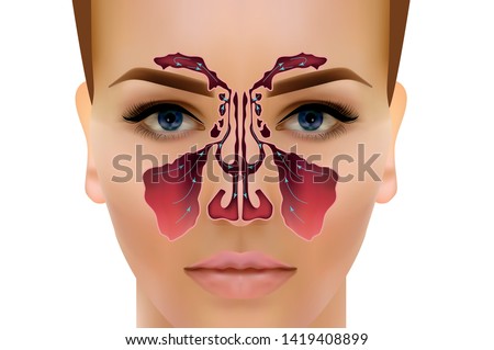 Sinusitis. Healthy and inflammation nasal sinus vector illustration Royalty-Free Stock Photo #1419408899