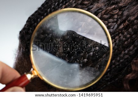 Close-up Of A Dandruff In Black Hair Seen Through Magnifying Glass