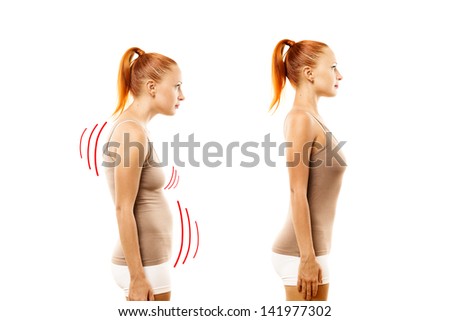 Young woman with position defect and ideal bearing on white background Royalty-Free Stock Photo #141977302