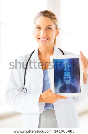 bright picture of female doctor with x-ray on tablet pc