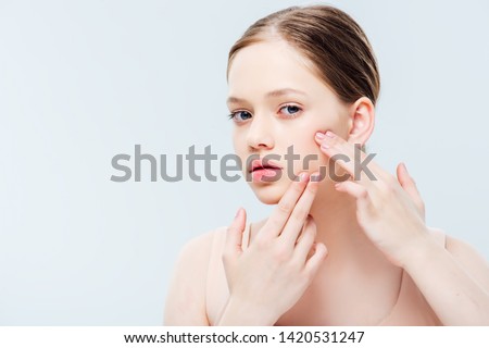 sad teenage girl having acne on cheek isolated on grey
