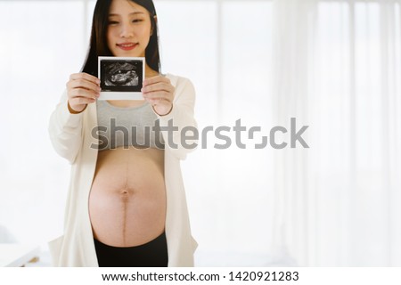 Hospital has ultrasound to help check the pregnancy for mother that the child is developing in the womb that is growing. And saw the image of the child moving in the womb Cause love Ties from unborn