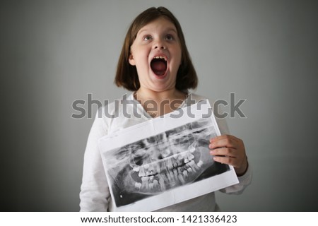 sad child girl with x-ray picture of teeth, x-ray of calf's and permanent teeth in the hands of a child. Funny children's emotions and children's health, dentistry