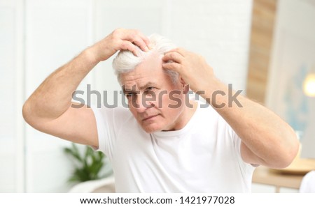 Senior man with hair loss problem indoors