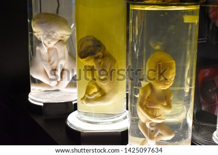 Fetus in formalin solution in the laboratory museum. A model for studying at a medical university. Unborn kids with malformations caused by nuclear radioactive accident like Hiroshima or Chernobyl. Royalty-Free Stock Photo #1425097634