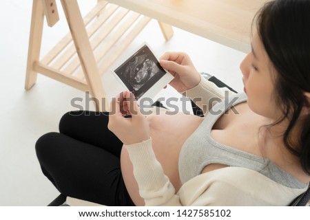 Close up of pregnant woman holding ultrasound scan. -Image