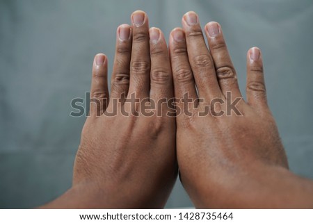 Men's hands, male skin, dry and rough, need skin care
