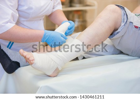 Nurse bandages the leg. Fracture of human lower limbs. Treatment of broken bones. Impose a gypsum. Patient surgical department. The doctor's hands tighten the bandage on his leg Royalty-Free Stock Photo #1430461211