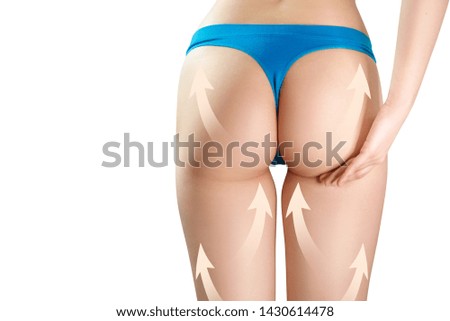 Female buttocks with bid white arrows demonstrate lifting effect. Isolated on white background.