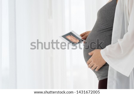 Close up of Pregnant woman holding ultrasound image. Concept of pregnancy
