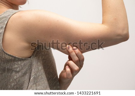 A young Caucasian woman wearing a crop top is seen up close against a white background. Pinching the loose and saggy muscles in the upper arm. Considering arm lift surgery. Royalty-Free Stock Photo #1433221691