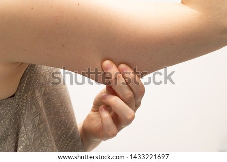 An extreme closeup view of the woman pinching the loose skin beneath her upper arm muscles. Fatty area of the human body. A common place for plastic surgery procedures in women. Royalty-Free Stock Photo #1433221697