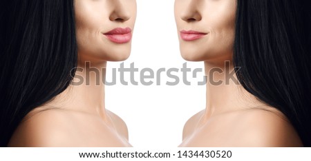 Comparison of female lips before and after  filler injections beauty plastic. Beautiful perfect woman lips with natural makeup. Plump lips augmentation salon procedure isolated on white background