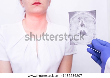 Doctor specialist holds X-ray picture on the background of a young girl who has tonsillitis of the throat and nasopharynx, inflammation of the lymph nodes