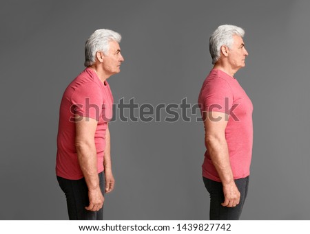 Mature man with poor and good posture on grey background Royalty-Free Stock Photo #1439827742