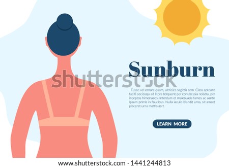 Sunburned woman back view cartoon character. Sun tanning damage danger concept. Skin redness flat vector illustration Royalty-Free Stock Photo #1441244813
