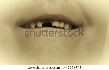 A six-year-old child. Replacing milk teeth with permanent ones. Close-up shot of a fallen tooth. Black and white image. Sepia. Picture taken in Ukraine, Kiev region