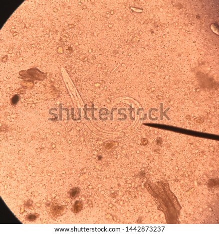 RHABDITIFORM Stock Photos and Images - Avopix.com
