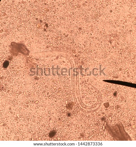 RHABDITIFORM Stock Photos and Images - Avopix.com