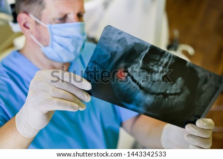 A male dentist holds an RTG image, an X-ray, a photograph of a wisdom tooth (eight) is colored red. Selective focus. Royalty-Free Stock Photo #1443342533