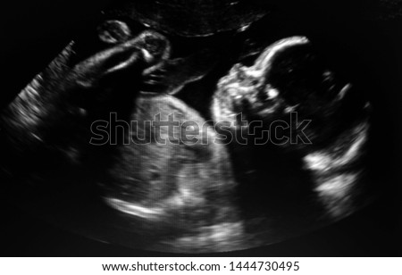 Ultrasound baby in a mother's womb.                              Royalty-Free Stock Photo #1444730495