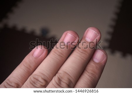 close up of an asian men finger nail 