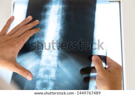 doctor examines x-ray picture of human spine