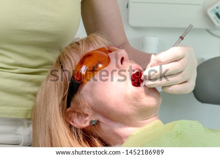 Dentist use a anesthetic oral gel to numb the area around tooth before injection of anesthetic solution..