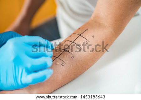 Immunologist Doing Skin Prick Allergy Test on a Woman’s Arm Royalty-Free Stock Photo #1453183643