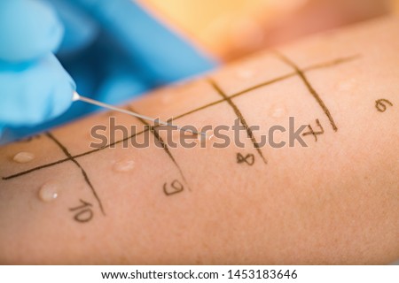 Immunologist Doing Skin Prick Allergy Test on a Woman’s Arm Royalty-Free Stock Photo #1453183646