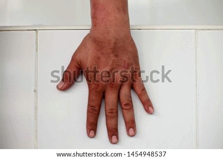 The hands of men that are both left and right, the background is white, this picture can be used for medical purposes.